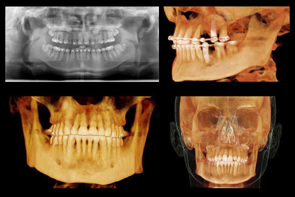 歯科用CT(デジタルレントゲン含む)